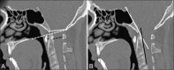 Figure 1 (A and B)
