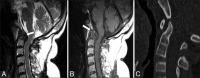 Figure 17 (A-C)
