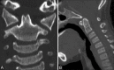 Figure 10 (A and B)