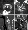 Figure 19 (A-D)