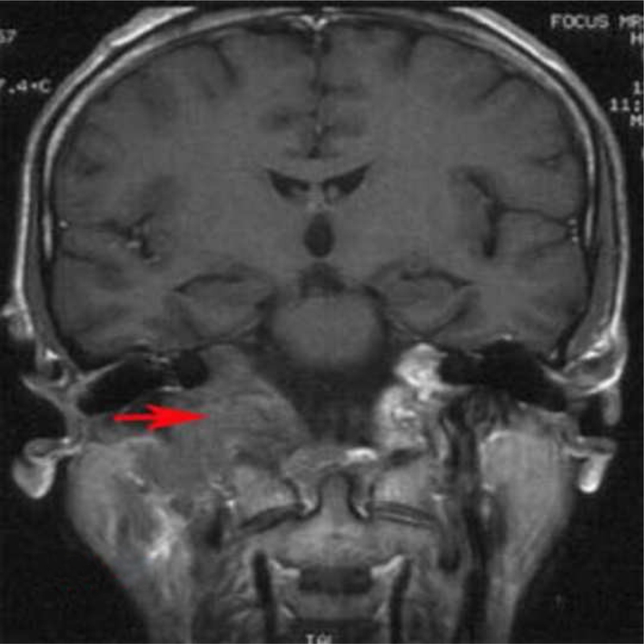 Fig. 3
