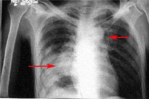 Fig. 1