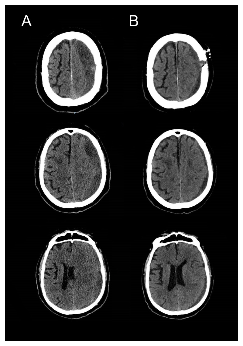 Figure 7. 