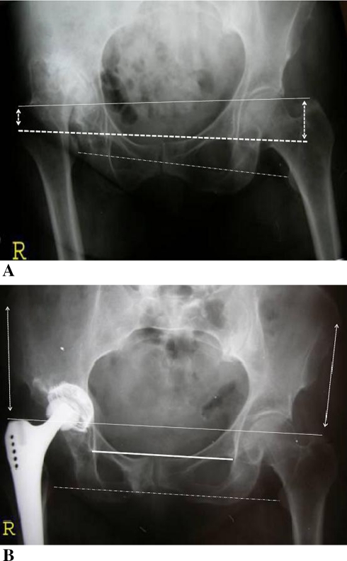 Fig. 1A–B