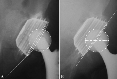 Fig. 3A–B