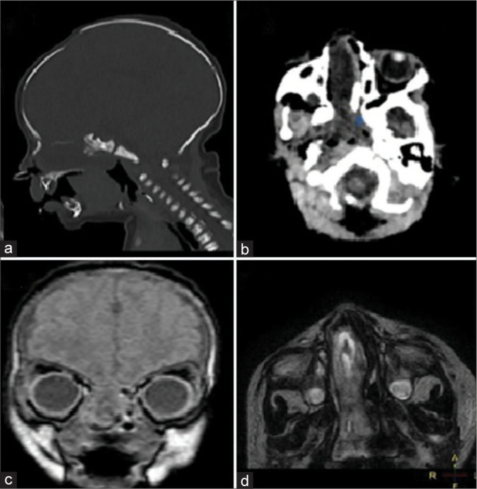 Figure 1: