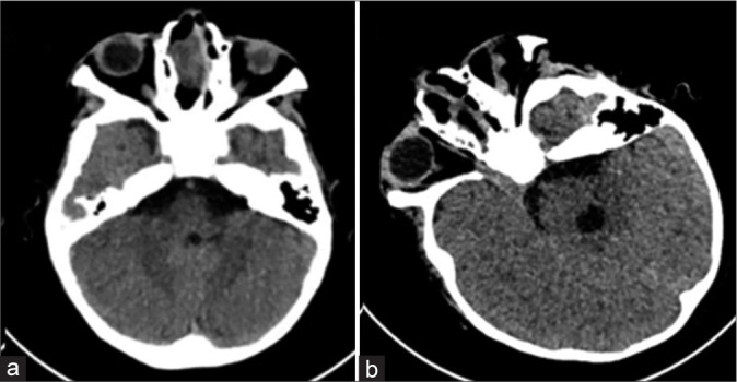 Figure 3: