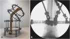 Fig. 11