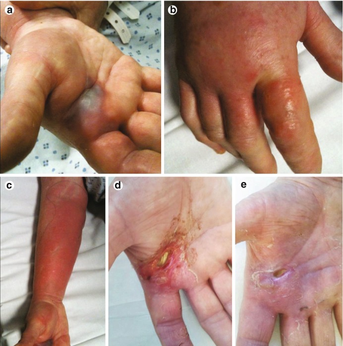 Fig. 23.15