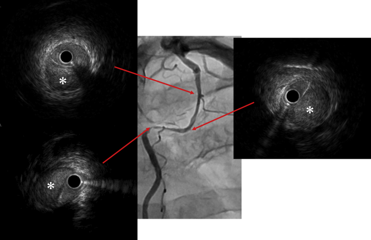 Figure 3