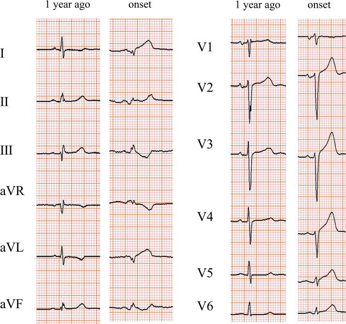 Figure 1