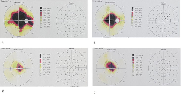 Fig. 2