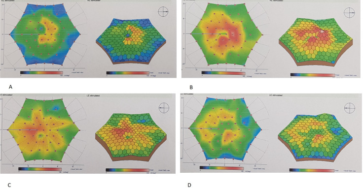 Fig. 3