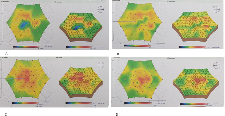 Fig. 4