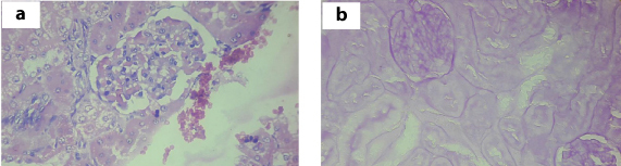 [Table/Fig-4]: