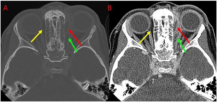 Fig 1.