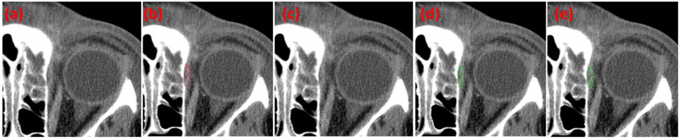 Fig. 5.