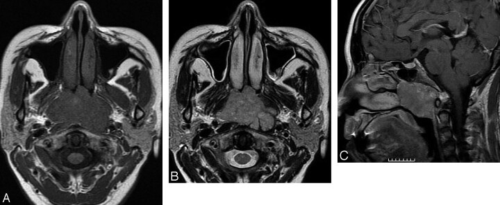 Fig 2.