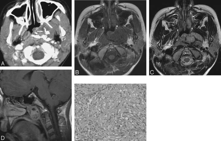 Fig 3.