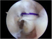 Fig. 6