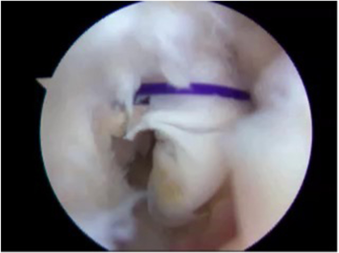 Fig. 6