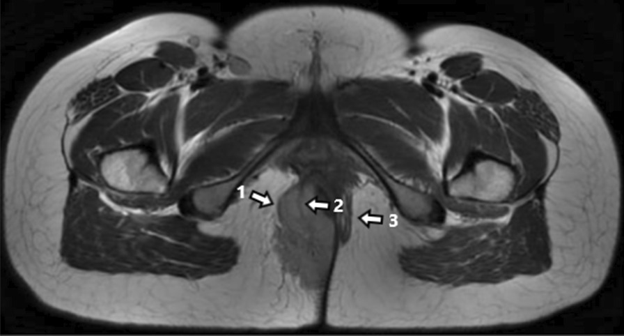 Fig.1