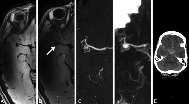 Fig 2.