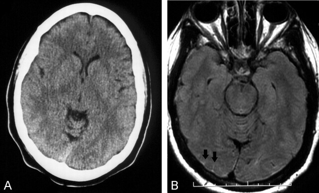 Fig 2.