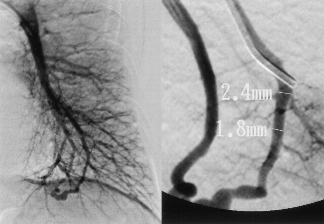 Fig 3.