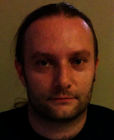 graphic file with name 216_2015_8793_Figf_HTML.jpg