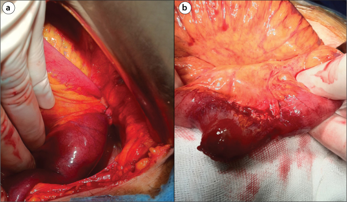 Figure 2. a, b.