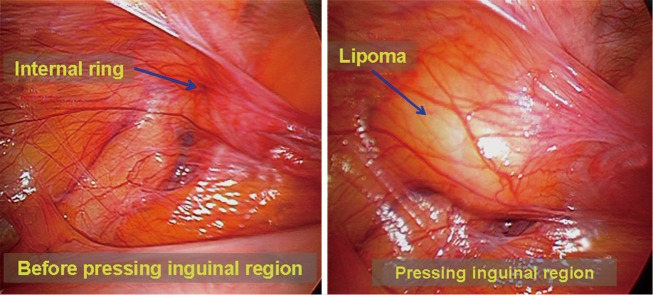 Figure 36