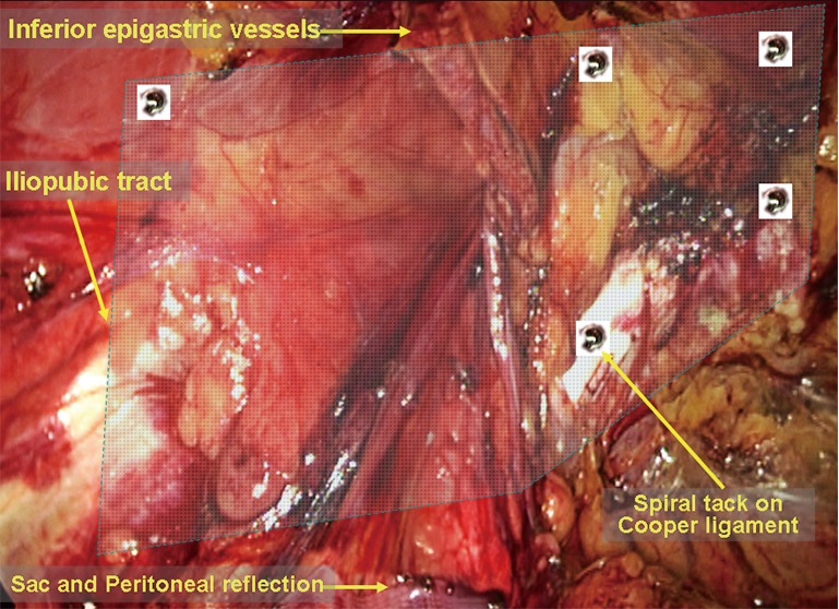 Figure 18