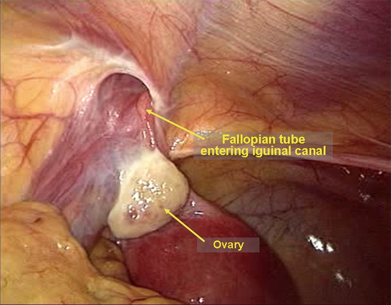 Figure 33