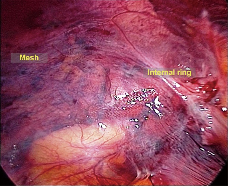 Figure 29