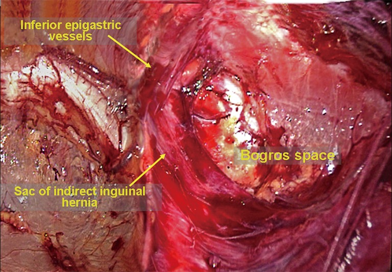 Figure 27