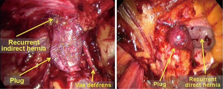 Figure 34