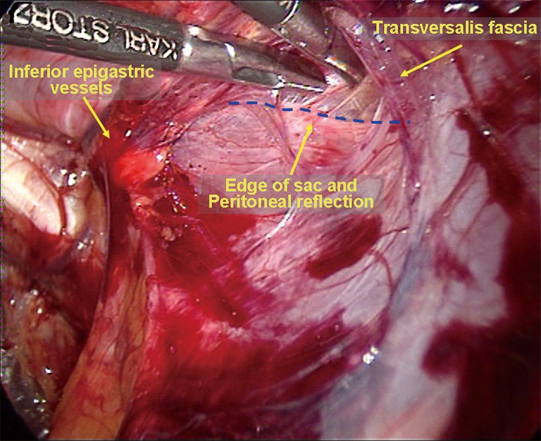 Figure 25