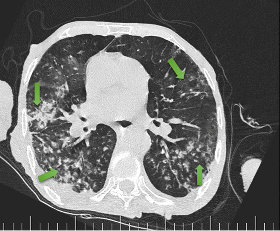 Fig. 3