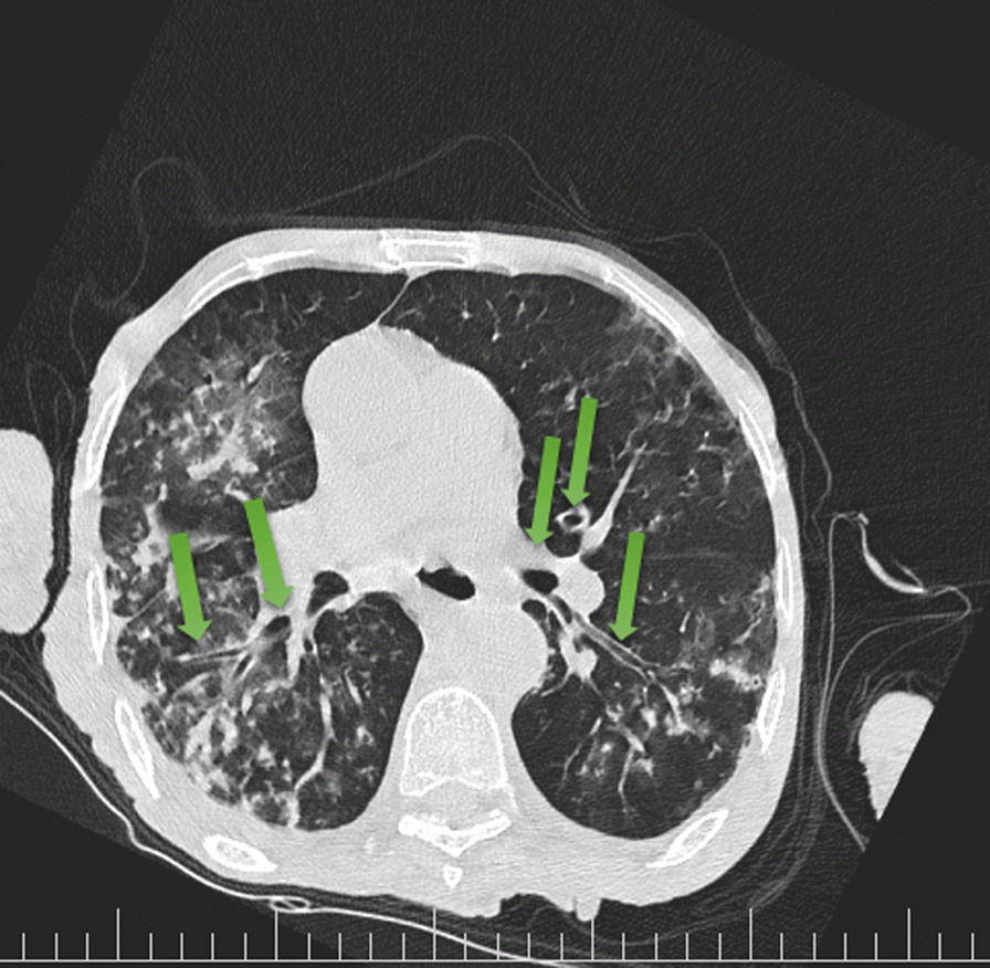 Fig. 4