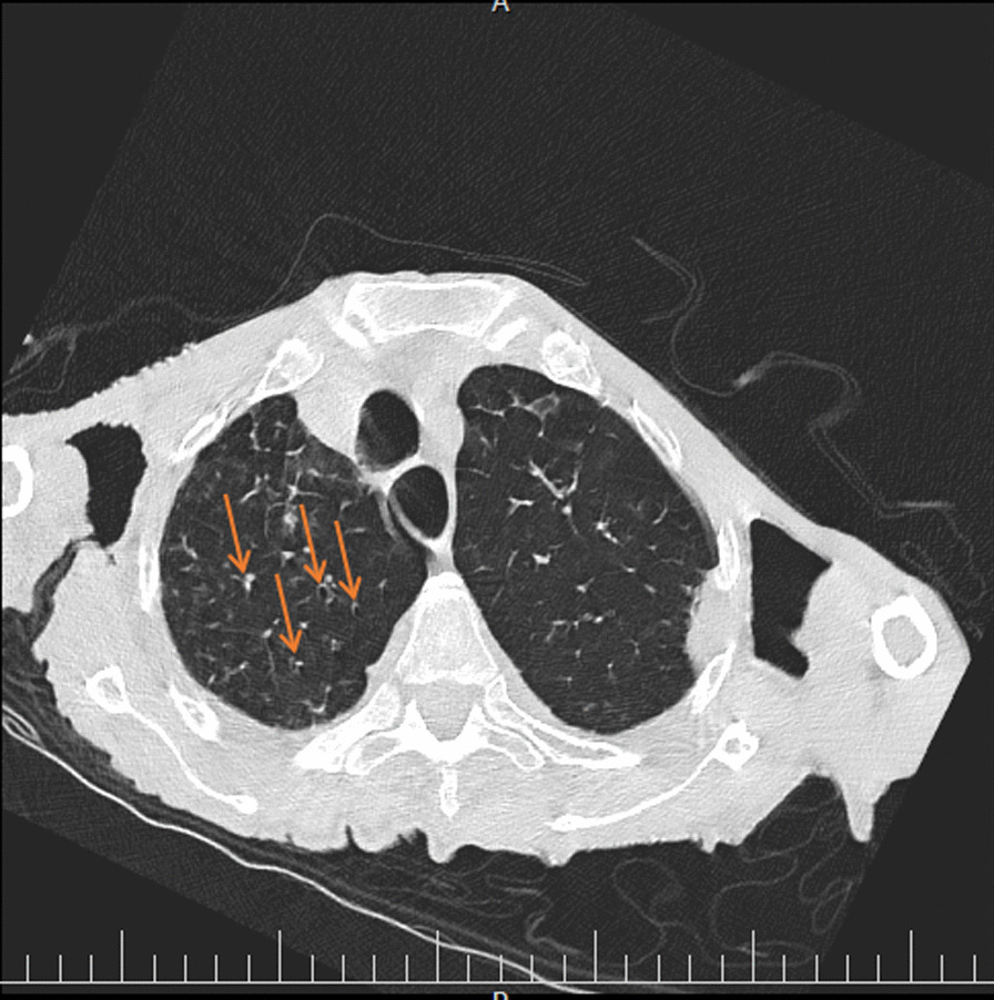 Fig. 2