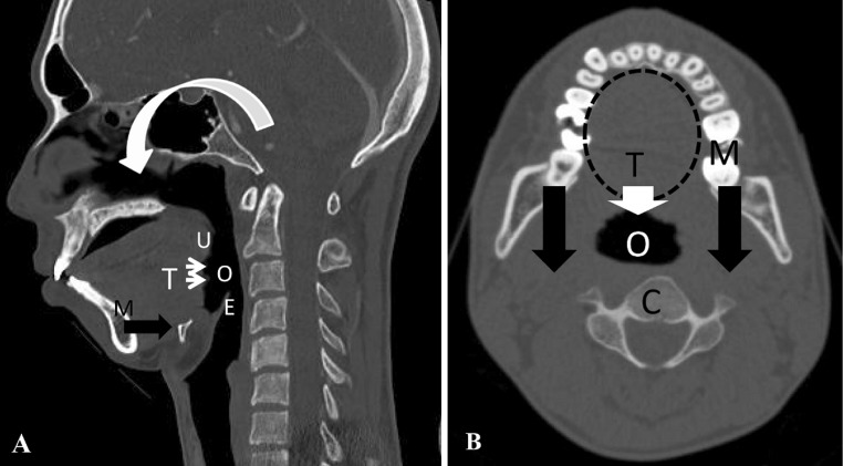 Fig. 1