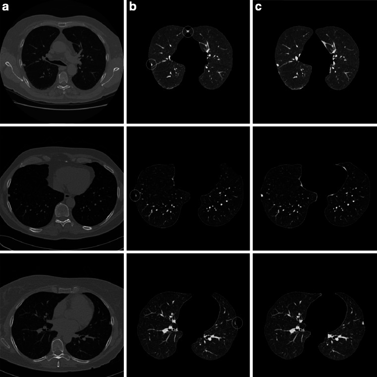 Fig. 15