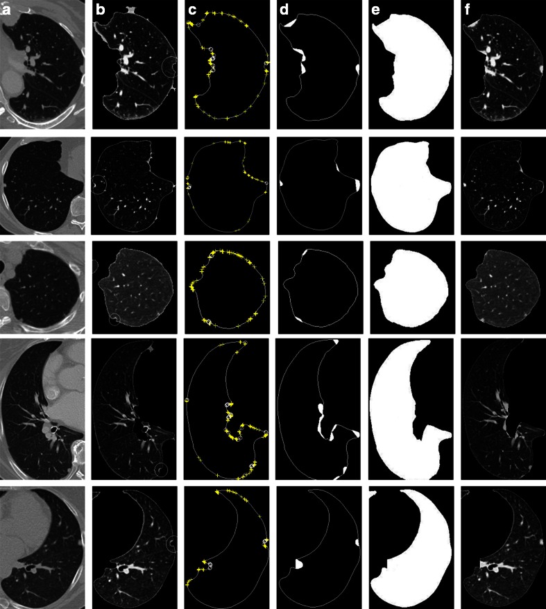 Fig. 14