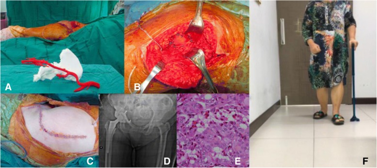 Fig. 13