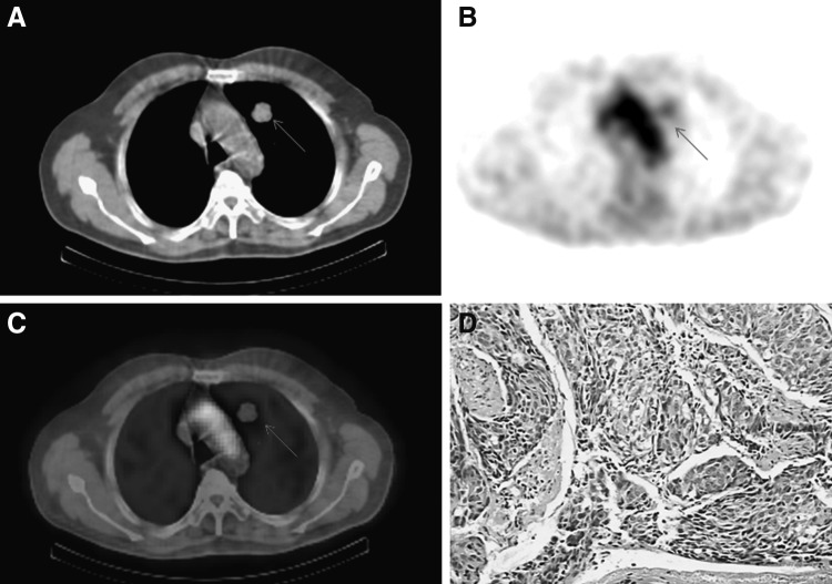 FIG. 1.