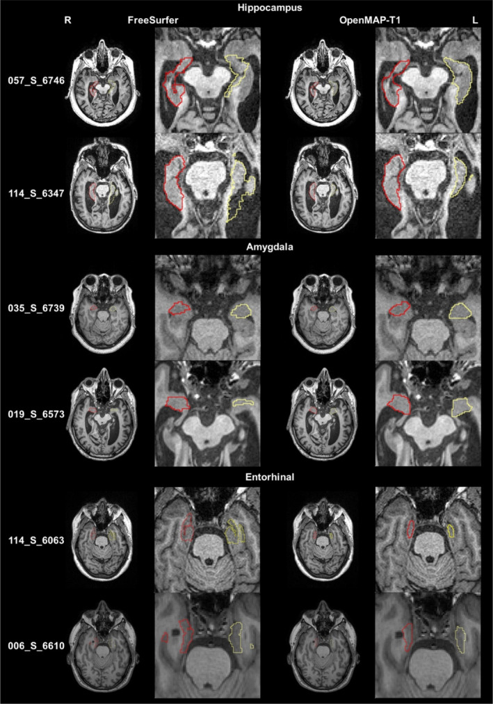 FIGURE 13