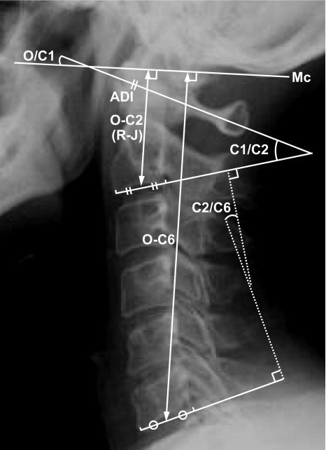 Fig. 1