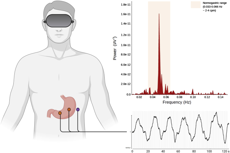 Figure 3