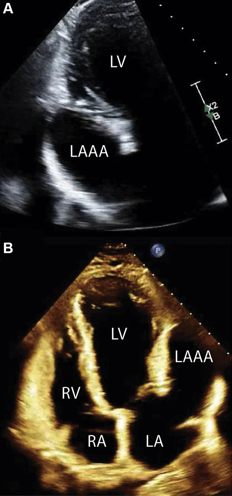 Figure 2